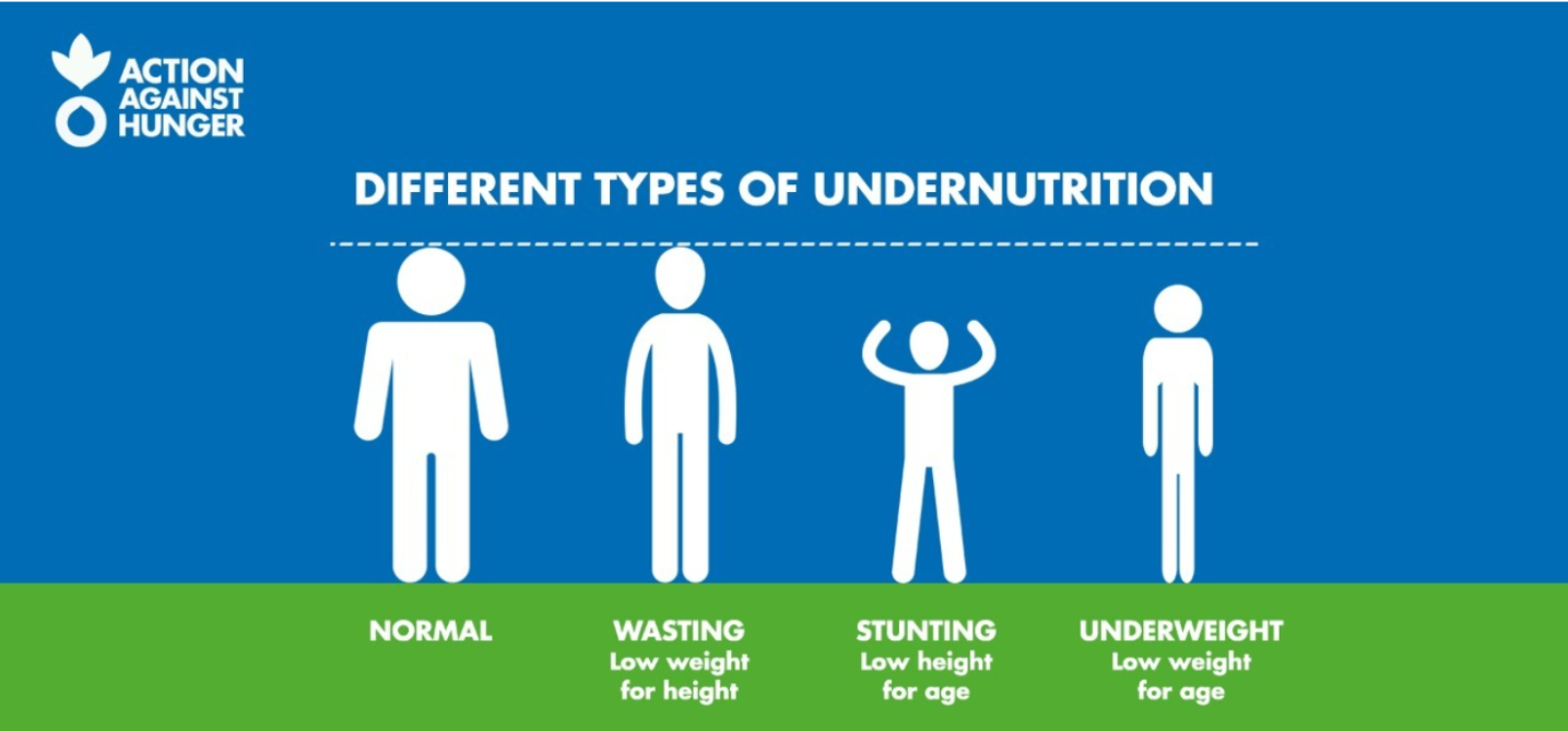 Types of Malnutrition and its Symptoms